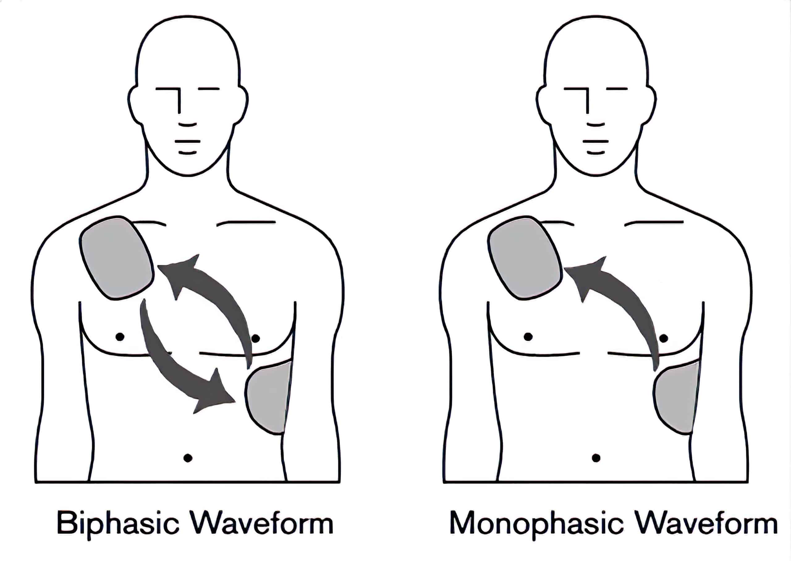 Biphasic and monophasic defibrillation waveforms.