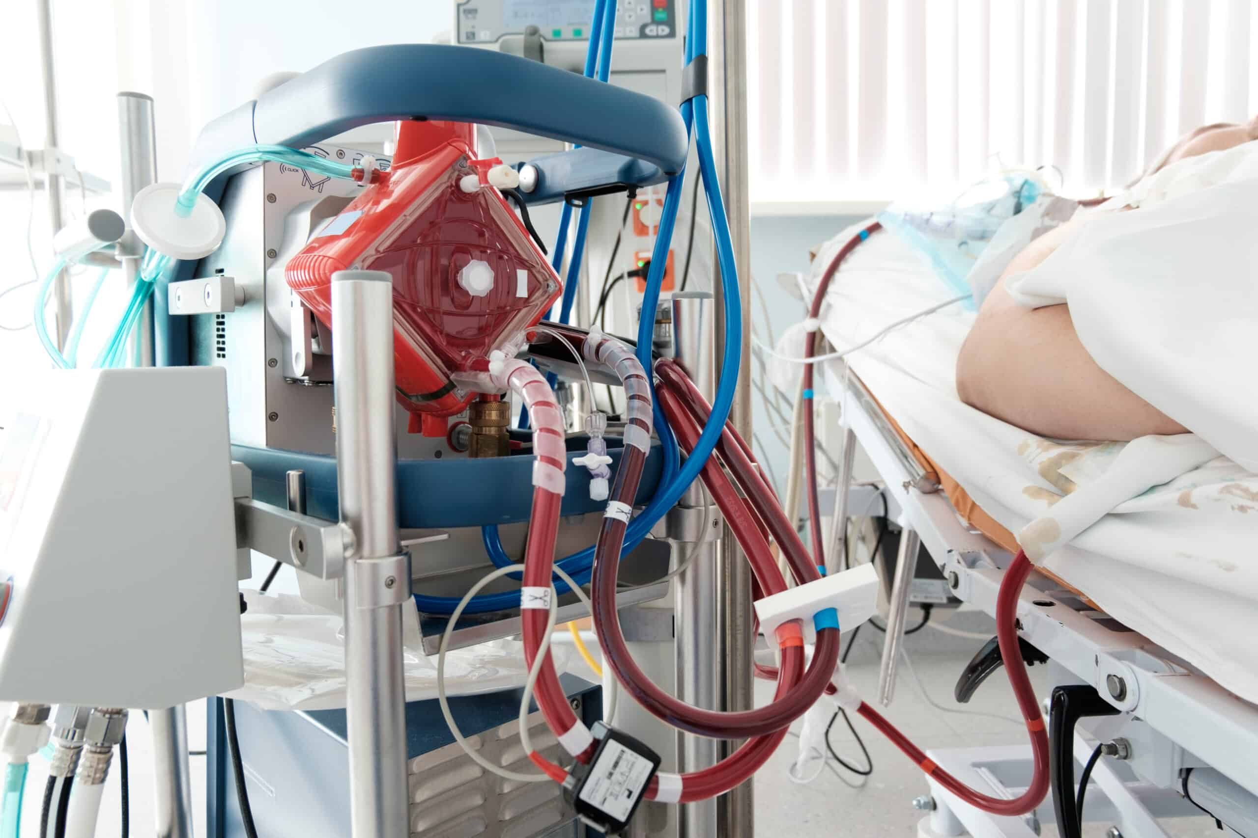 ECMO machine acts as heart and lungs.