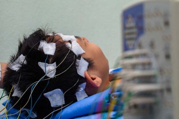 Patient undergoing electroencephalogram.