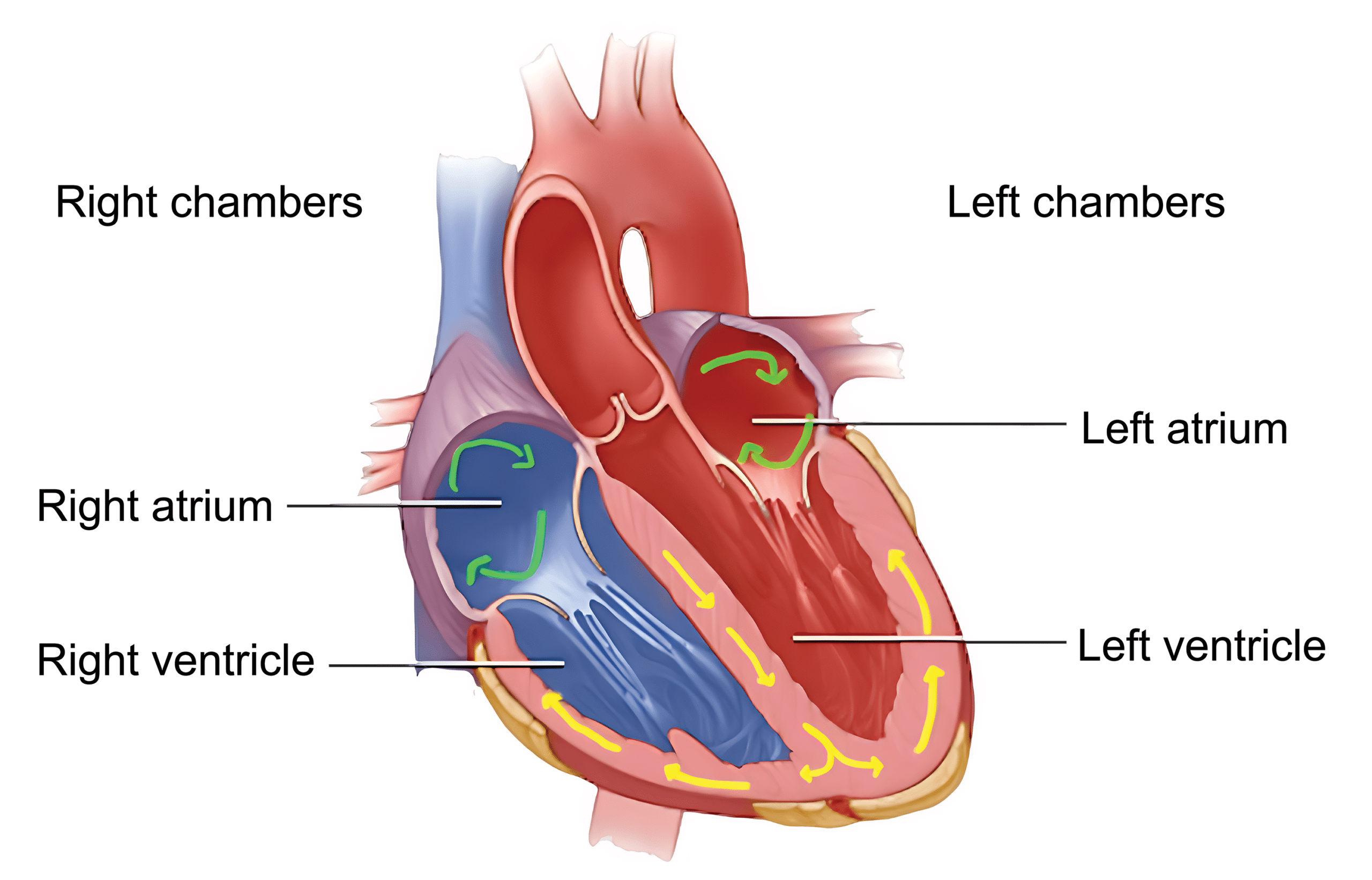 Diagram of the heart during a PJC.