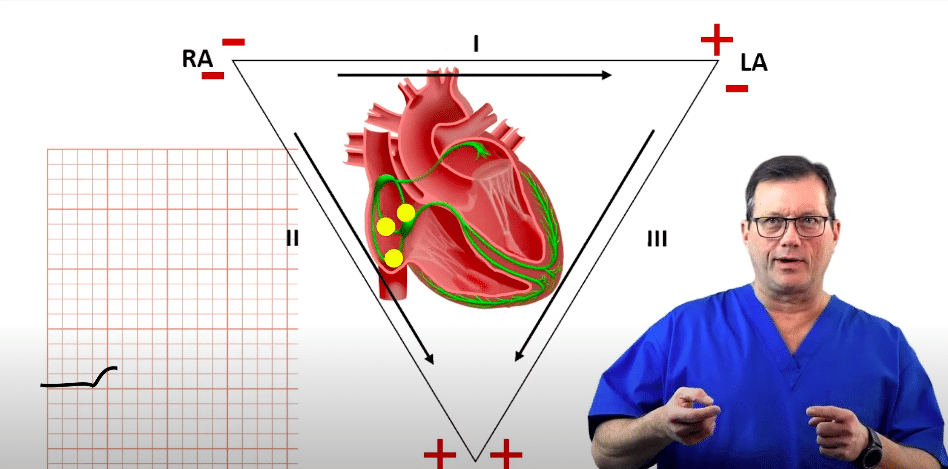 Heart conduction diagram - SA node.