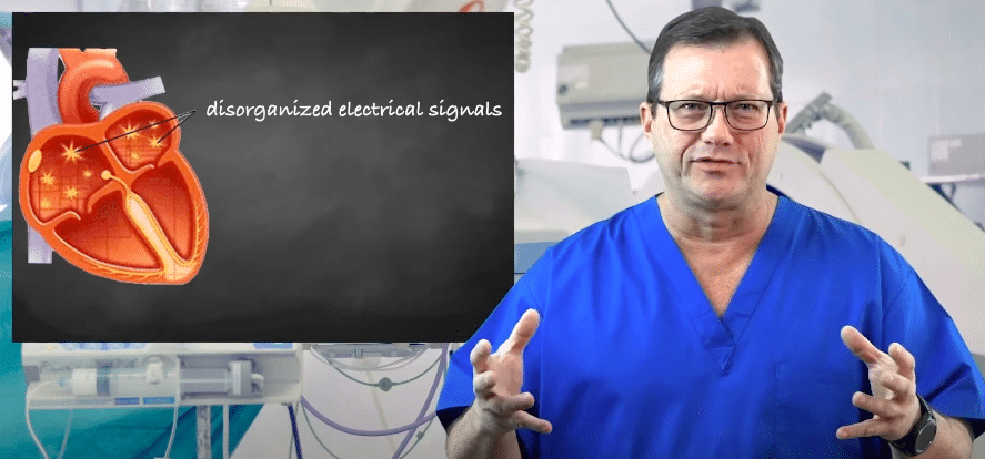 No P waves present during atrial fibrillation.
