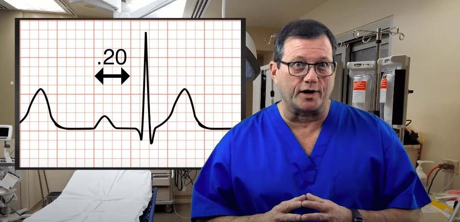 QRS complex on ECG grid.