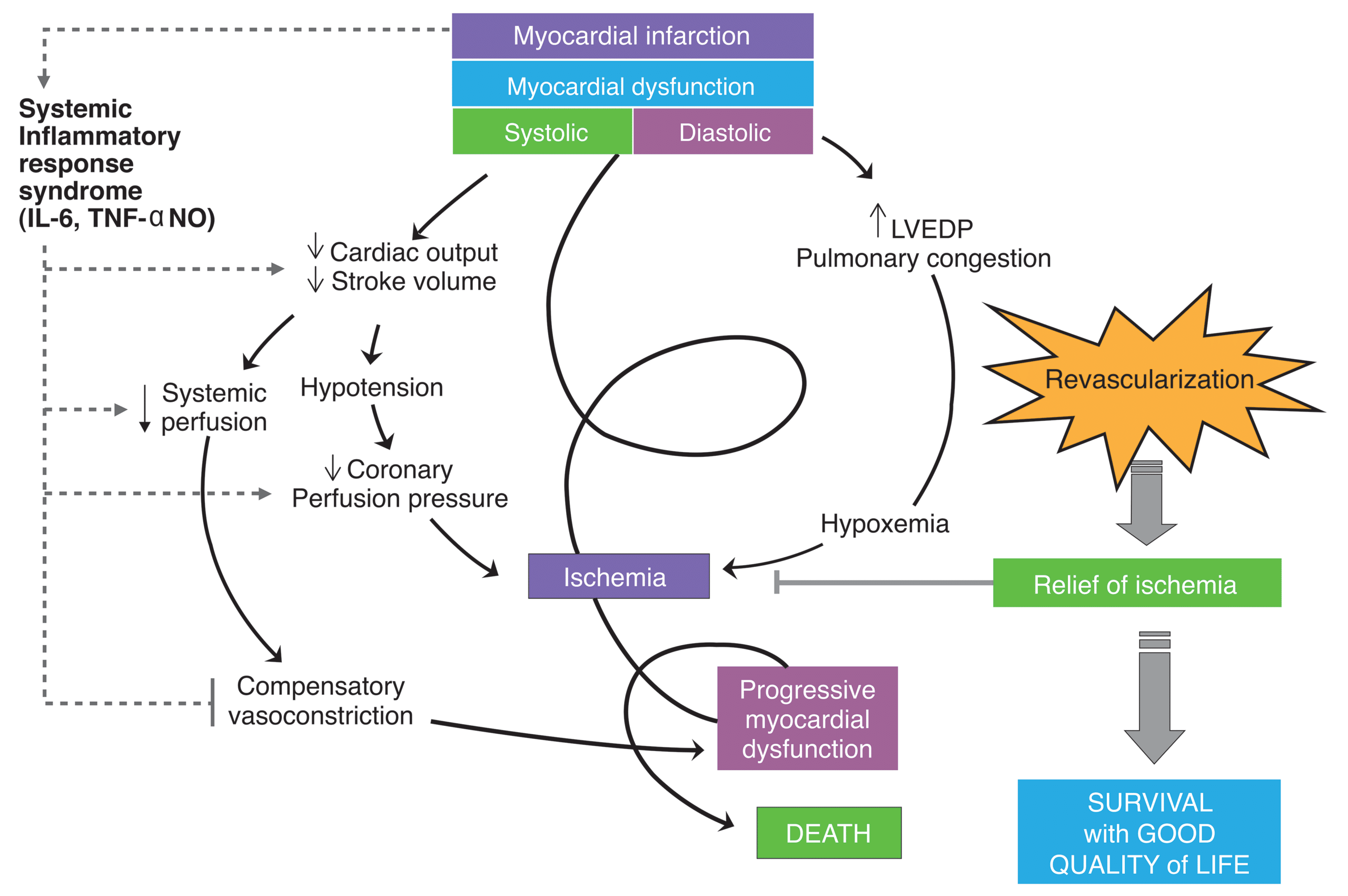 Cardiogenic shock paradigm.