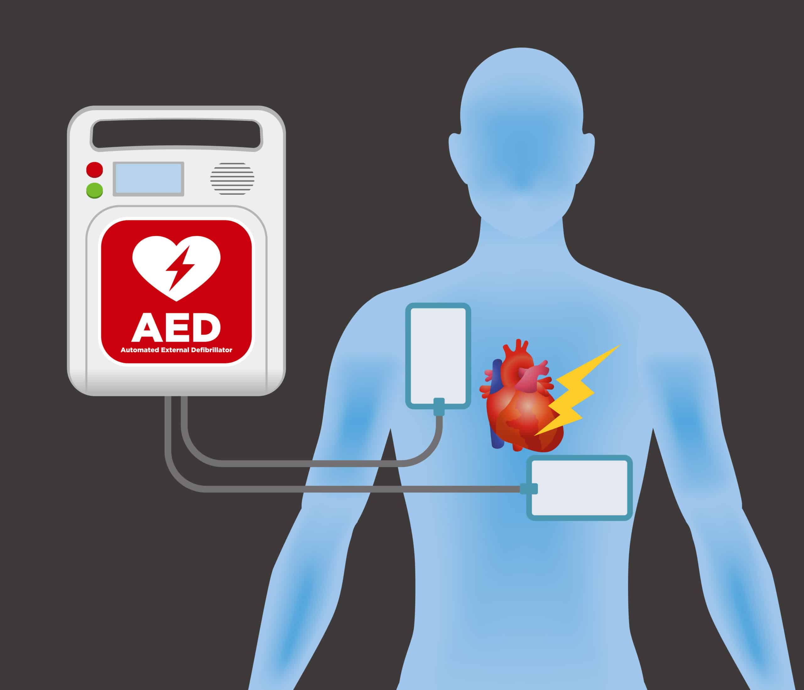 VF and PVT: Care of the Patient with a Shockable Rhythm