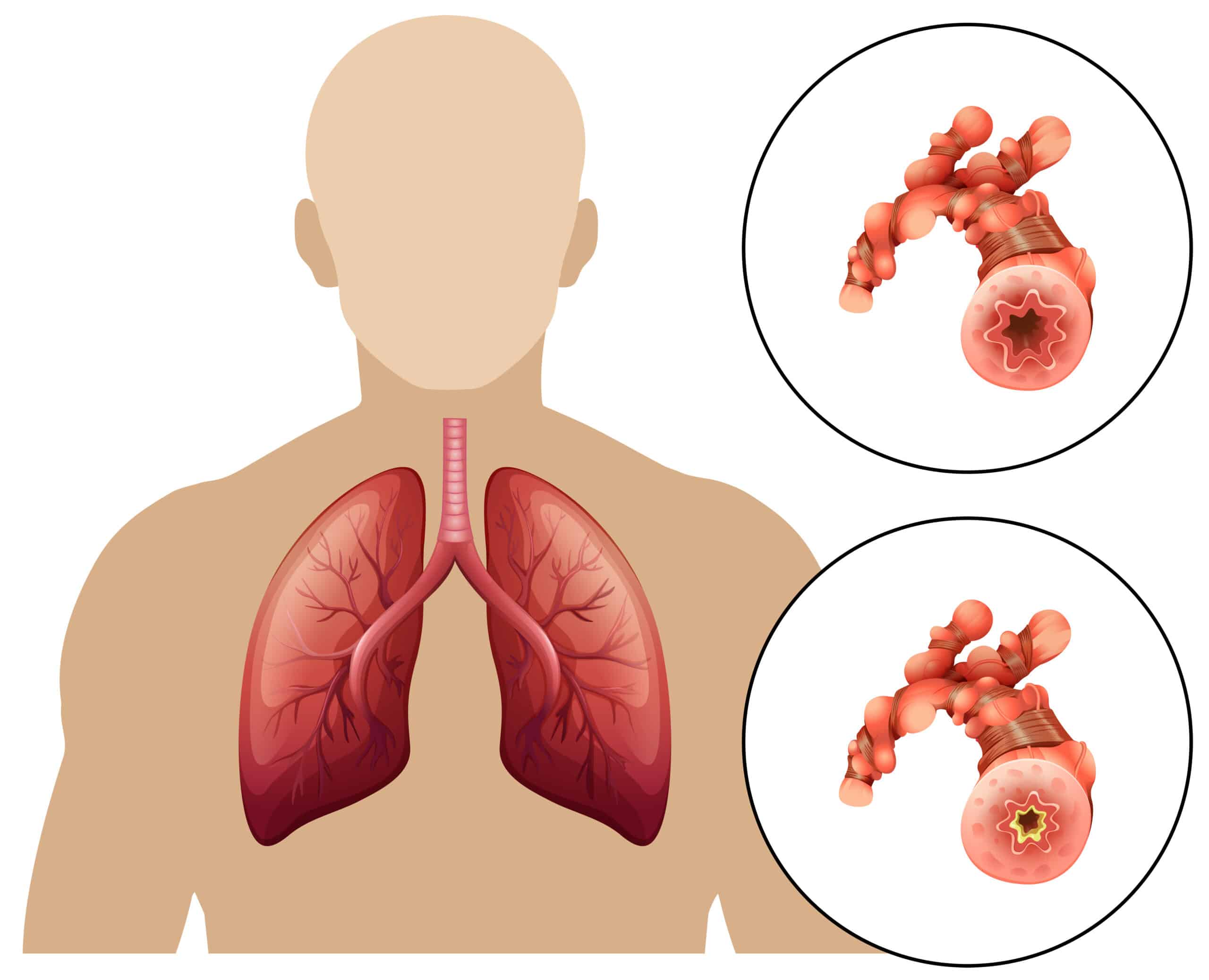 Respiratory Drugs: Part 2