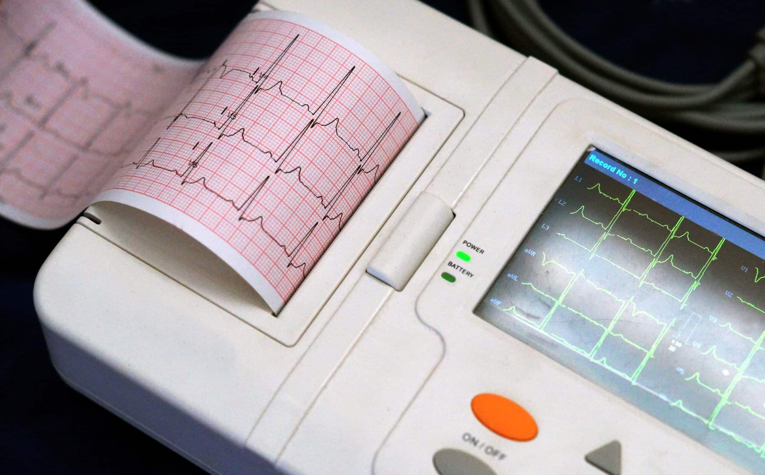 Electrocardiogram machine.