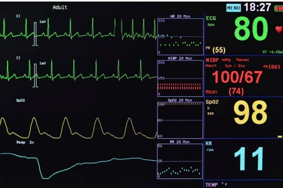 Vital signs include blood pressure, heart rate, and respiratory rate.