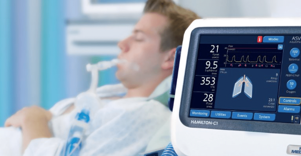 Adaptive Support Ventilation