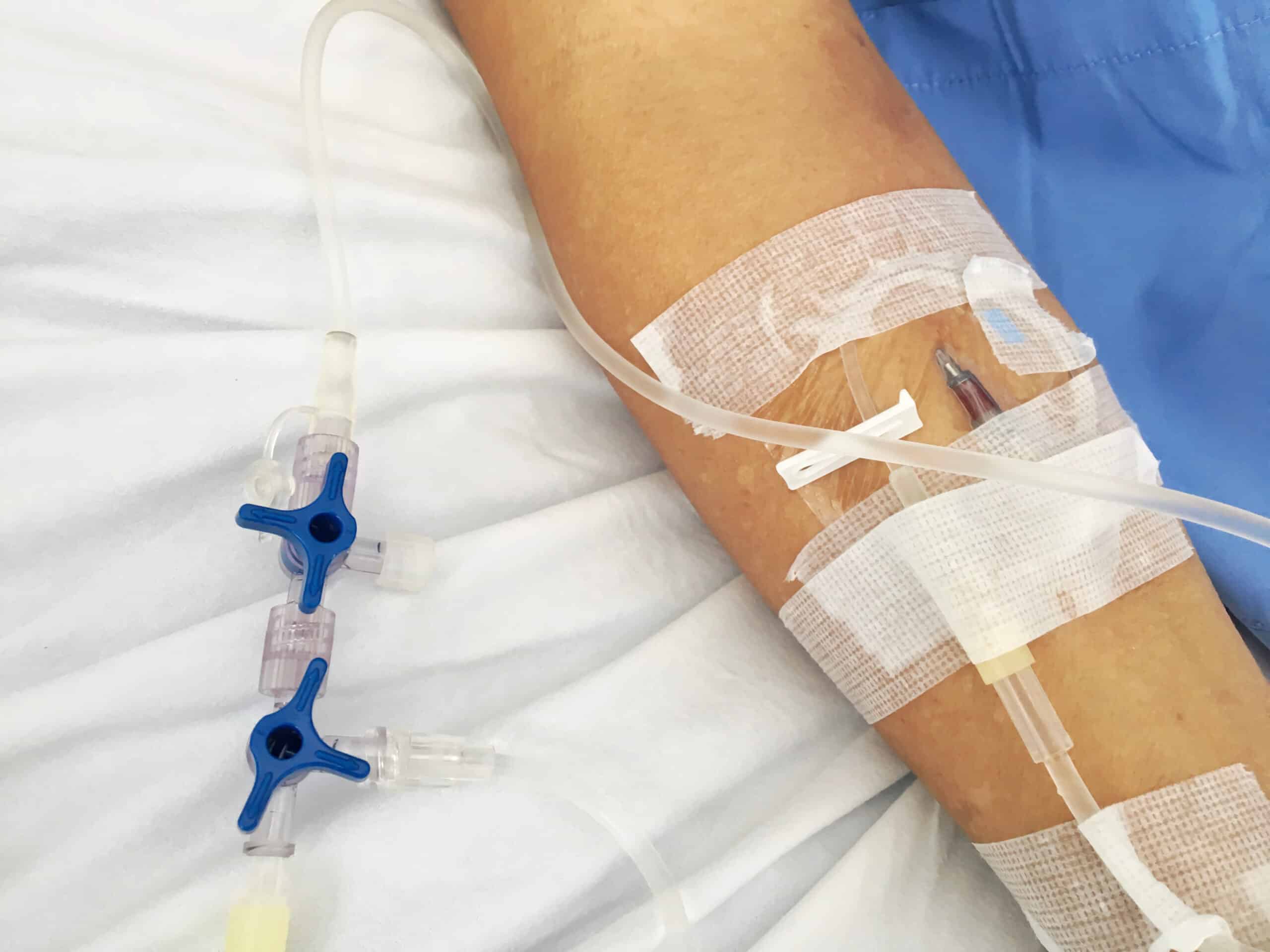 Assessment of IV site - IV inserted into an arm.
