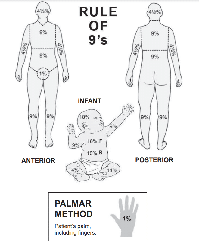 The Rule of Nines - diagrams of the body.