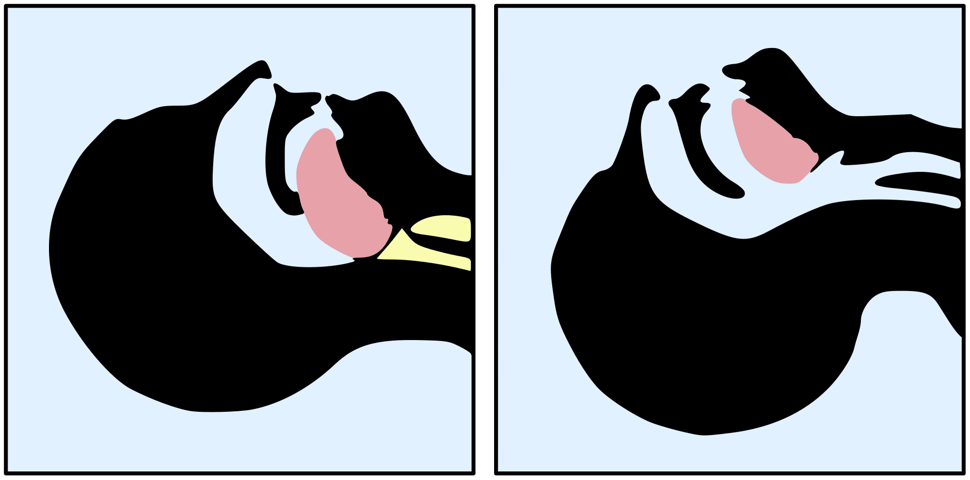 Anatomy of head tilt-chin lift maneuver.