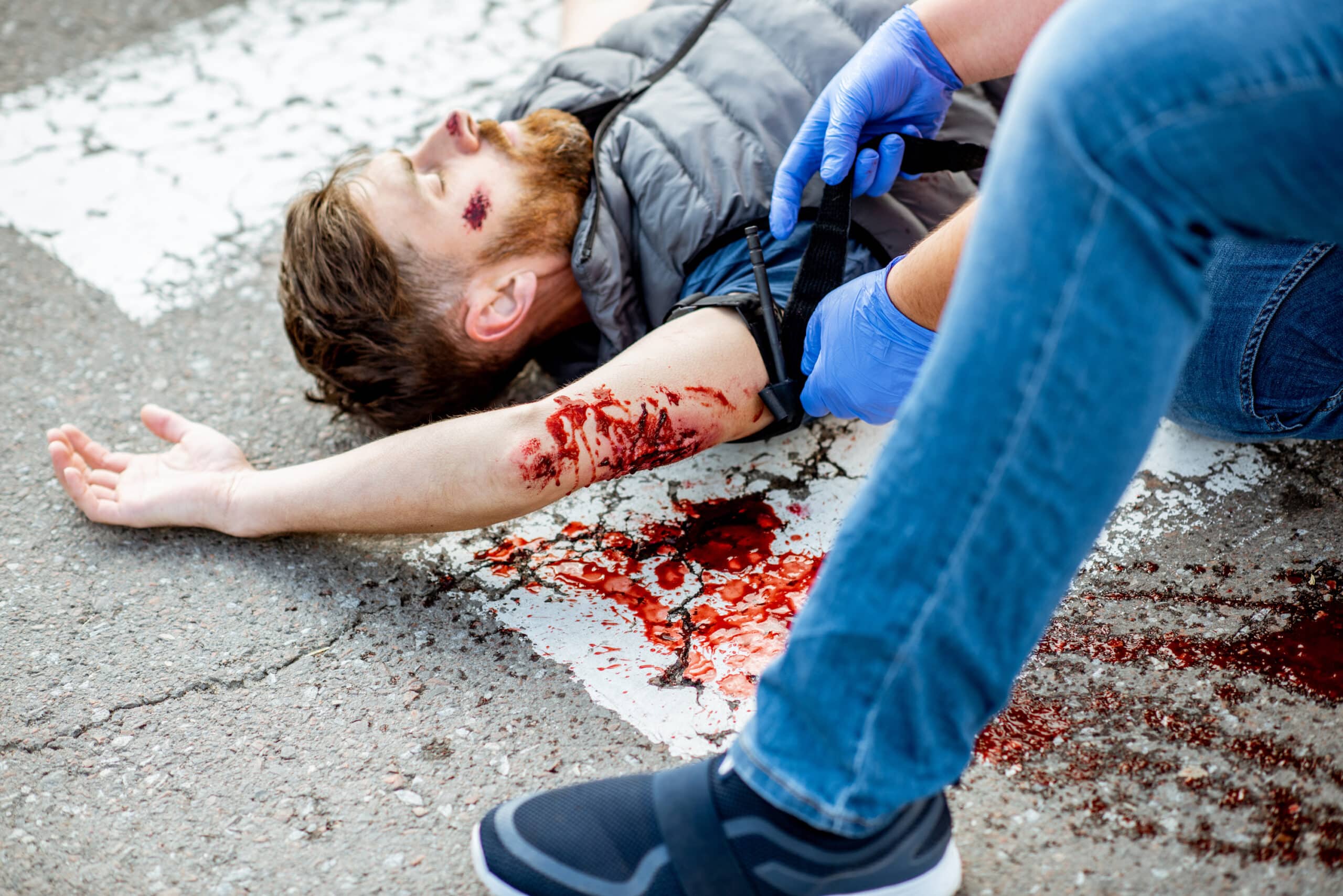 Applying tourniquet to stop the bleeding.