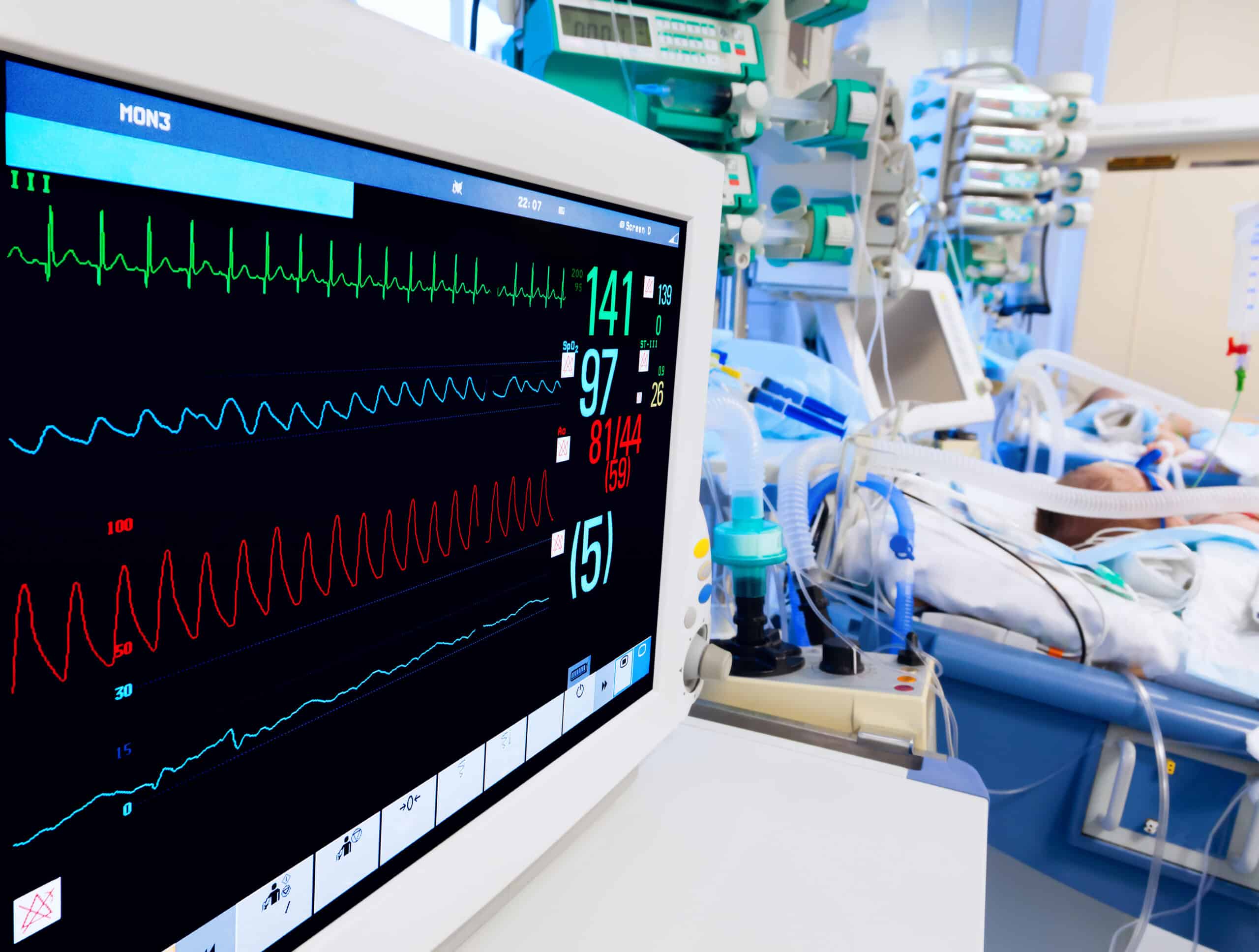 ECG monitor in a neonatal unit.
