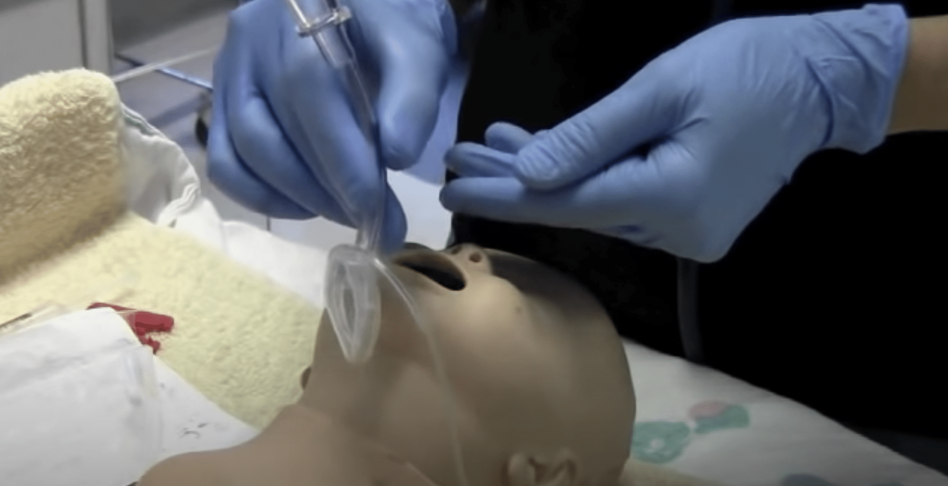 Gloved medical clinician inserting a laryngeal mask airway.