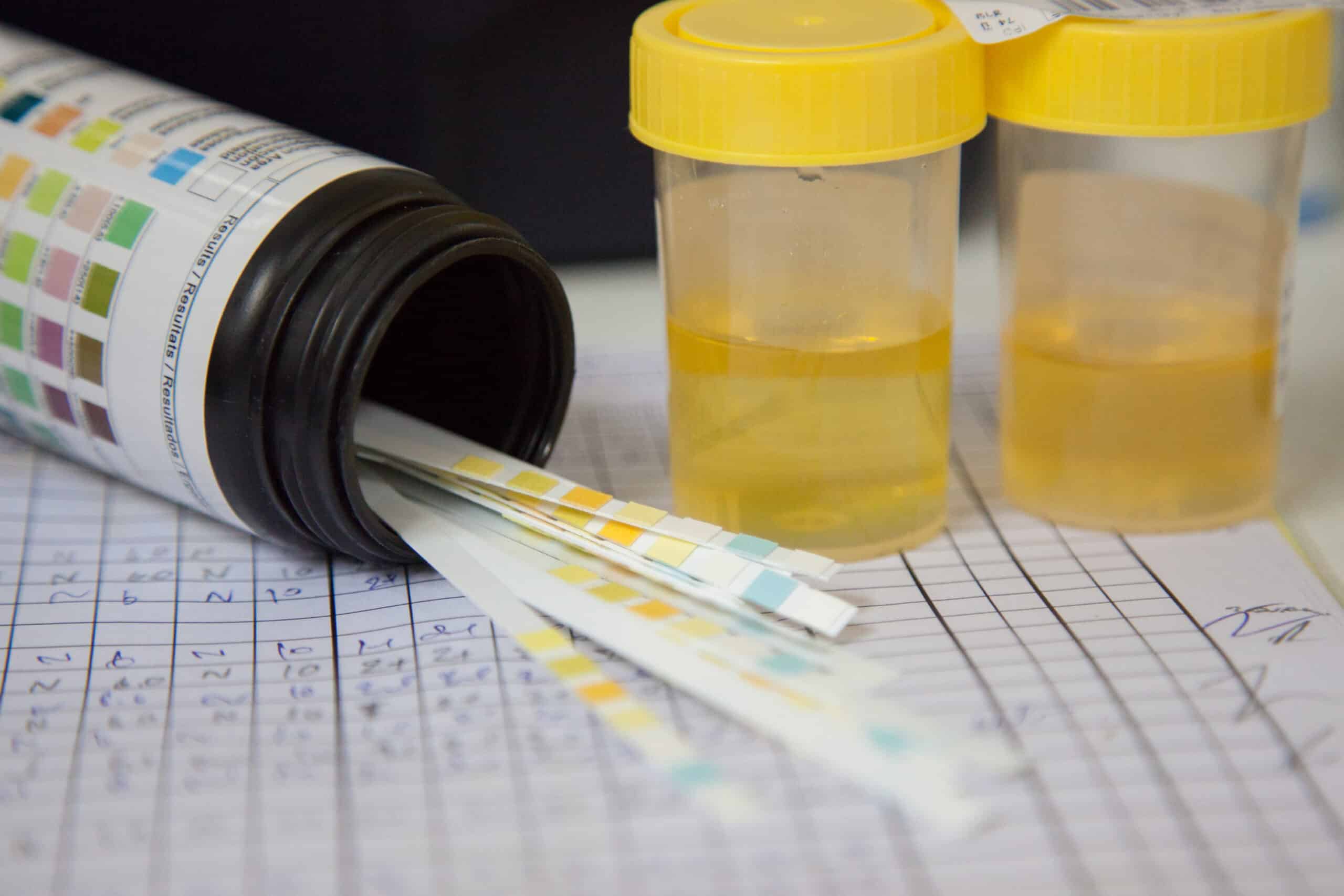 Ketone test.