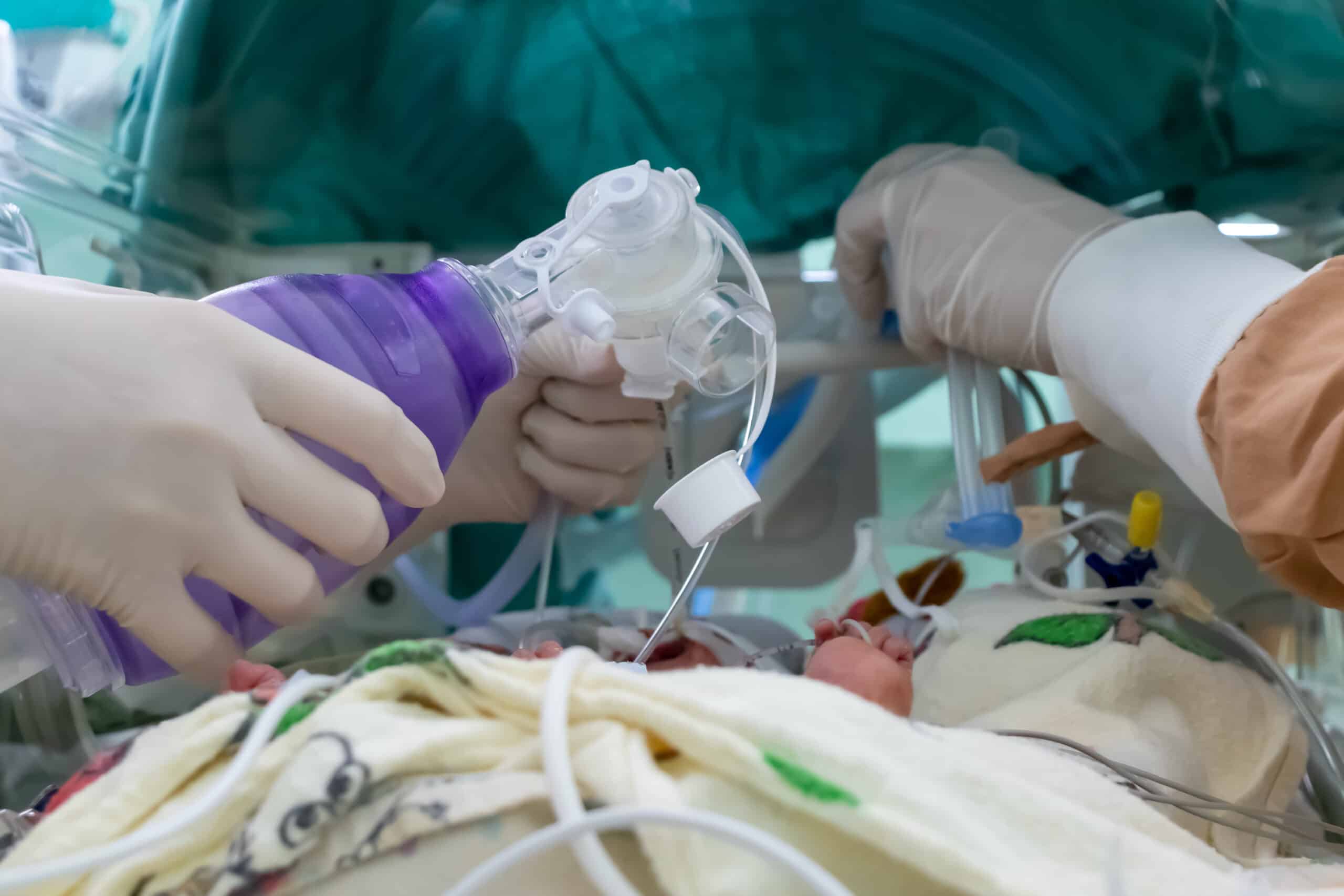 Medical clinicians placing ventilation equipment on a neonate.