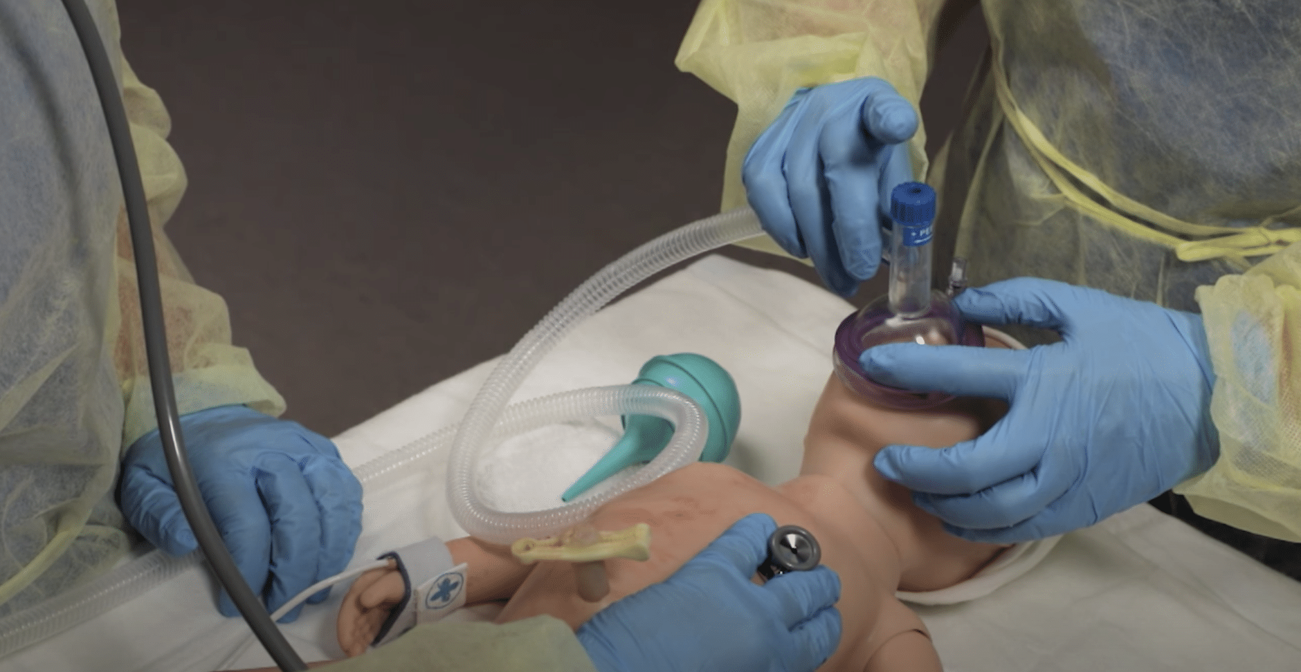 Neonate receiving positive pressure ventilation with the assistance of two gloved clinicians.
