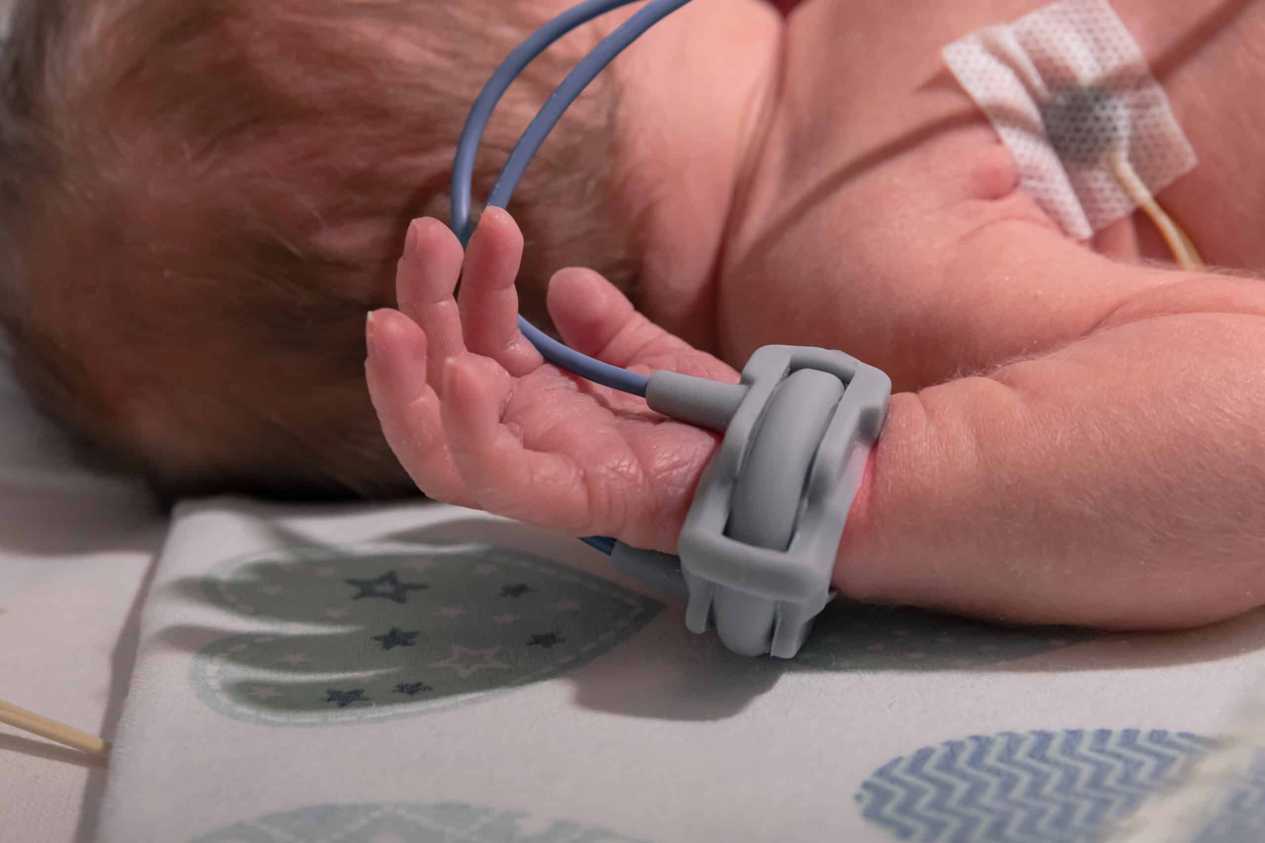 Neonate wearing a gray pulse oximeter around its wrist.
