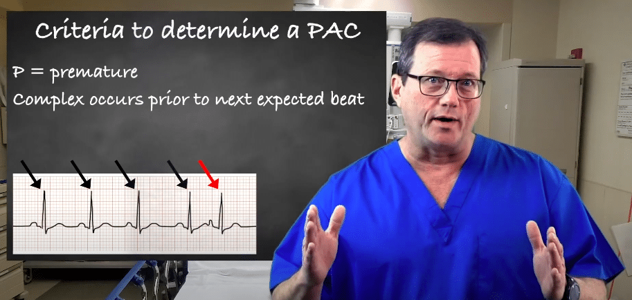 Red arrow points to complex prior to next beat.