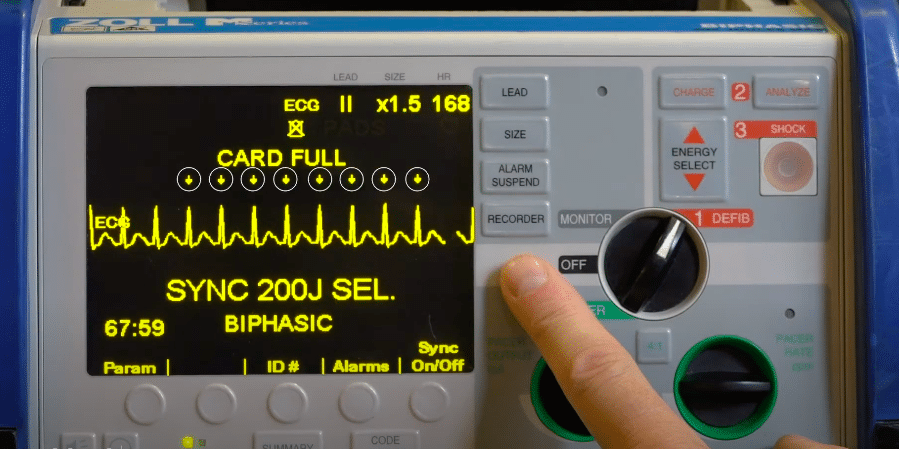 Hash marks on ECG monitor.
