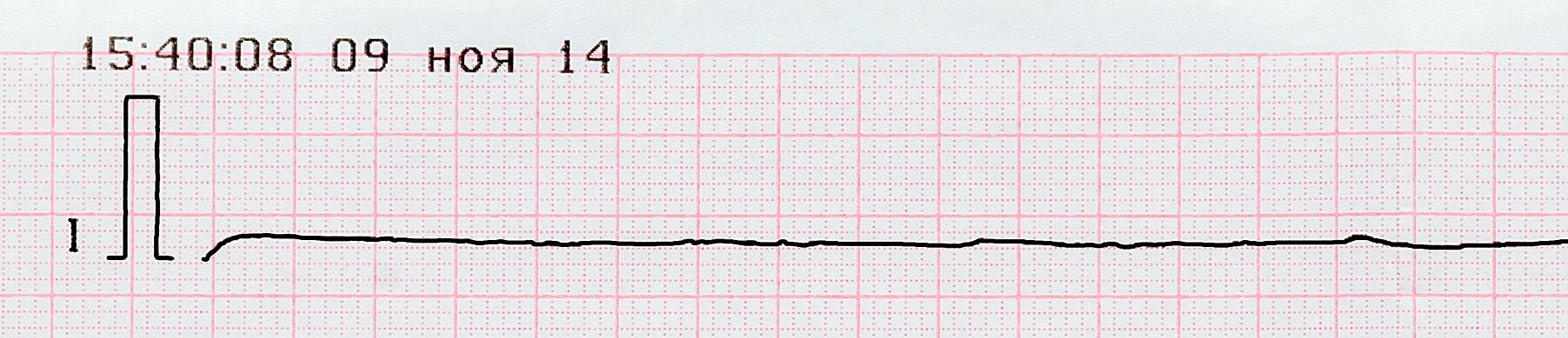Asystole - ECG tracing.