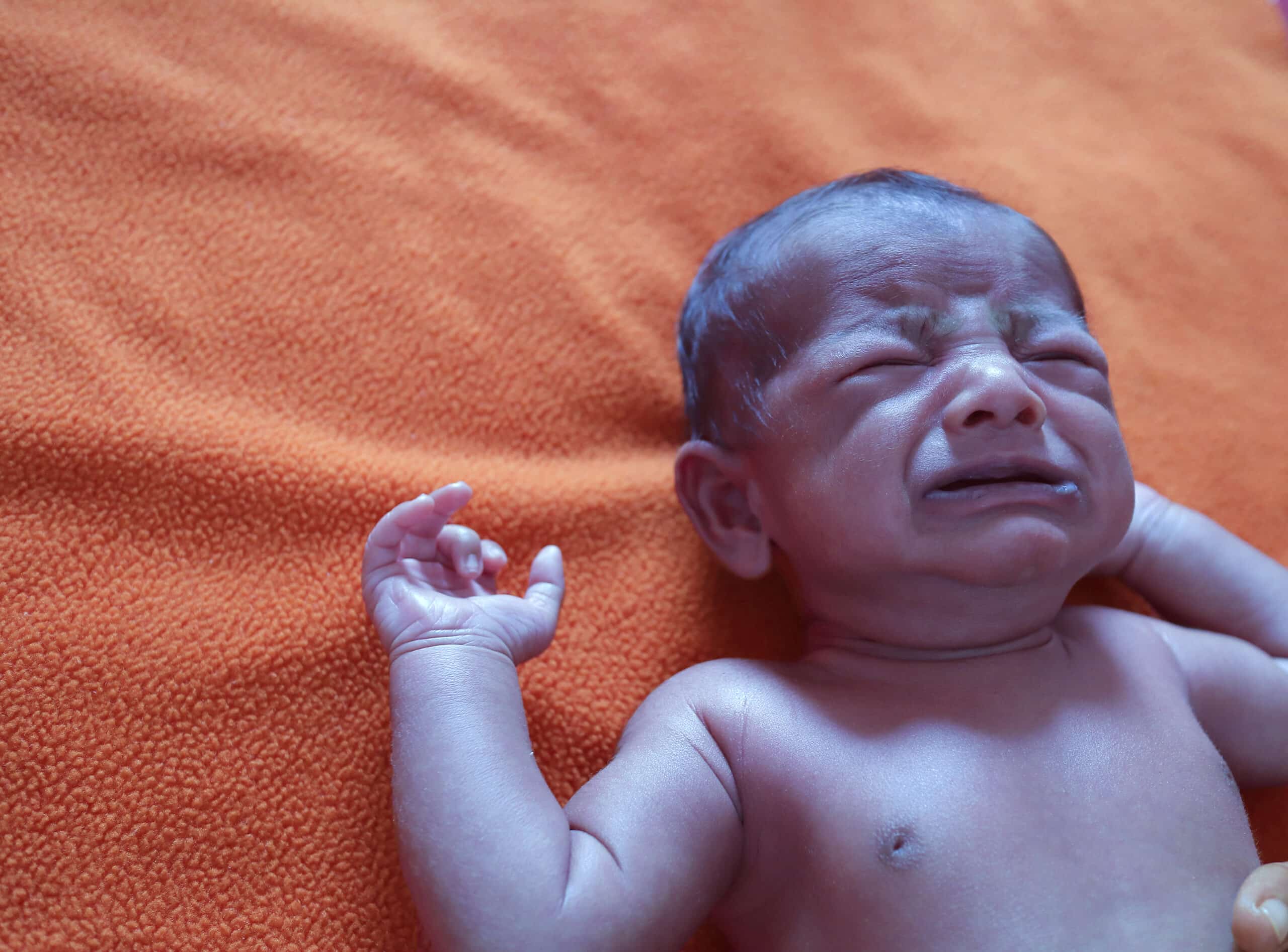 Neonate with bluish skin due to cyanosis.